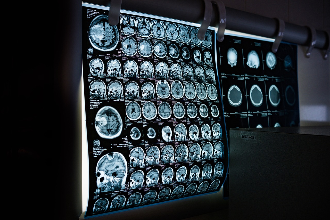What Is Turbine Oil Neurotoxicity?